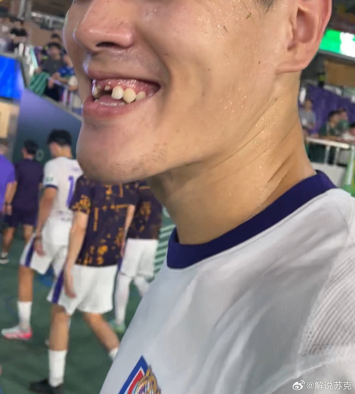 开云体育平台-😨太惨了！津门虎0-2不敌浙江，中卫王献钧门牙在比赛中被撞掉